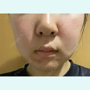 口コミ