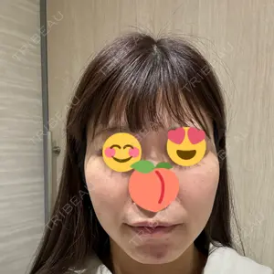 口コミ