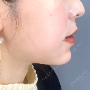 口コミ