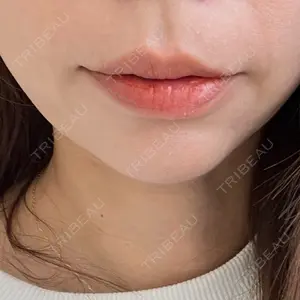口コミ
