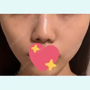 口コミ