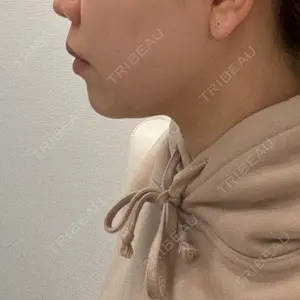口コミ