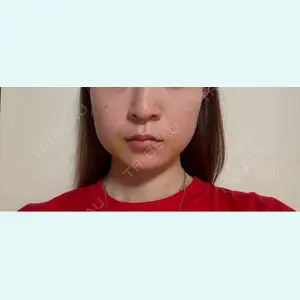 口コミ