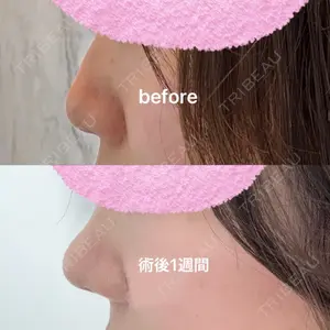 口コミ