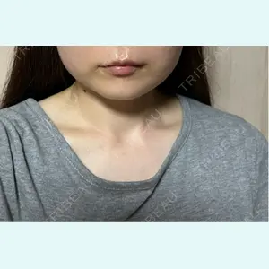 口コミ