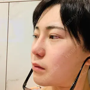 id（アイディ）美容外科のヒョン･ウォンソク医師口コミ