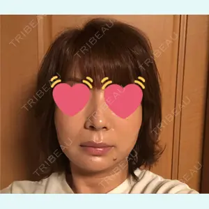 TCB東京中央美容外科 渋谷西口院の富田 莉沙子医師口コミ