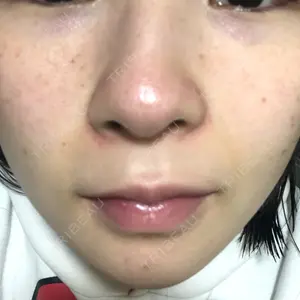 NANA（ナナ）美容外科のキム・ジョンヨン医師口コミ