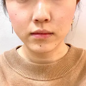 Beauty Connection Ginza Clinic（BCGクリニック）の小林　智子医師口コミ
