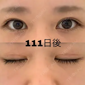 111 days after image