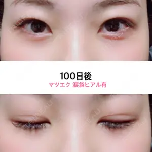 100 days after image