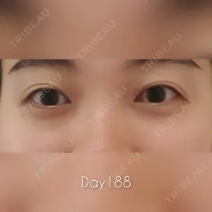 189 days after image