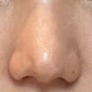 30 days after image