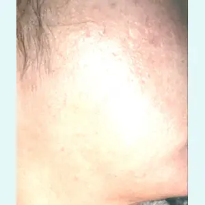 10 days after image