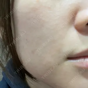 オラクル美容皮膚科 東京新宿院の古市 雅子医師口コミ