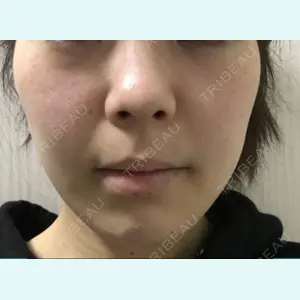 id（アイディ）美容外科のパク・サンフン医師口コミ
