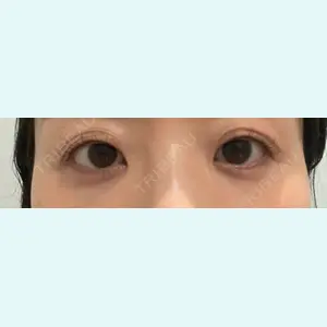 口コミ