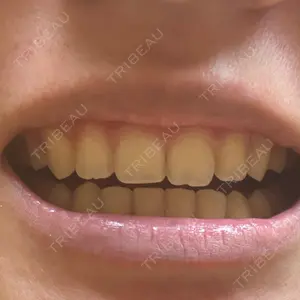 オーラルビューティークリニック クラリス審美歯科・矯正歯科口コミ