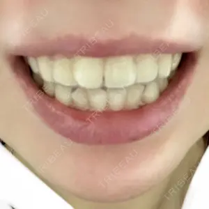 Shiny Teeth Clinic 【シャイニー ティース クリニック】口コミ