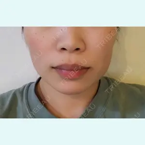 AI Beauty Clinic （エーアイ美容クリニック）口コミ