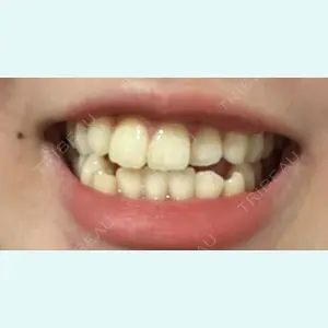 Shiny Teeth Clinic 【シャイニー ティース クリニック】の高橋 直人医師口コミ