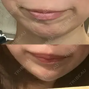 EMMO FACE CLINIC 大宮院の廣松 直樹医師口コミ