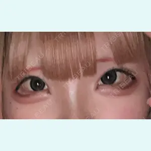 口コミ