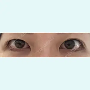 口コミ