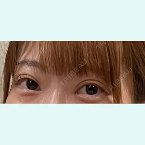 口コミ