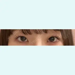 口コミ