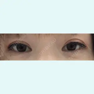 口コミ
