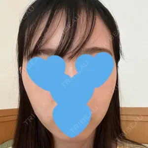 口コミ