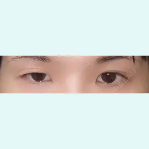 口コミ