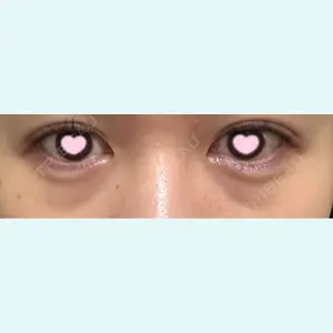 口コミ