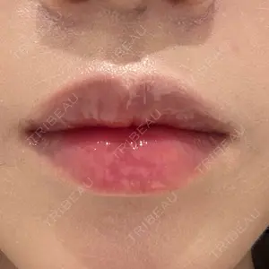 口コミ
