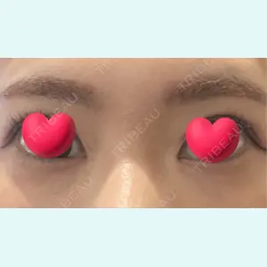 口コミ