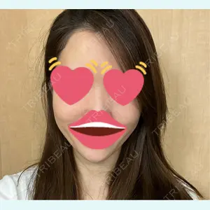 口コミ