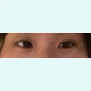 口コミ