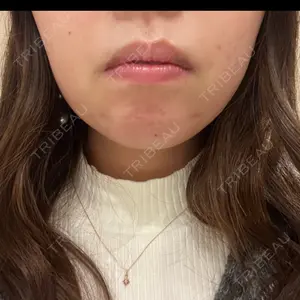 口コミ