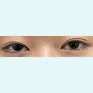 口コミ
