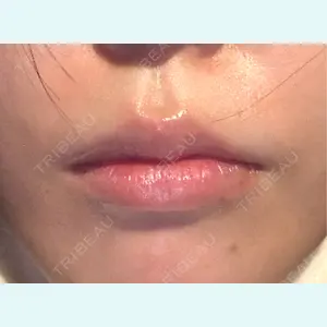 口コミ