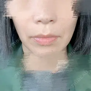口コミ