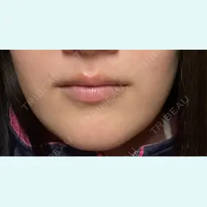 口コミ