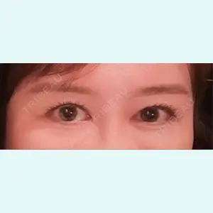 口コミ