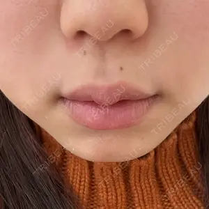 口コミ