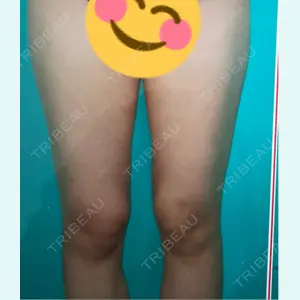 口コミ