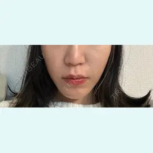 口コミ