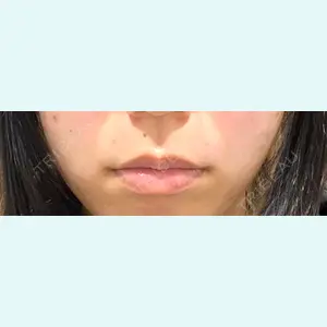 口コミ
