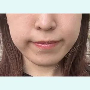 口コミ