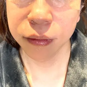 口コミ